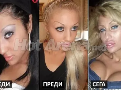 Ужасяващи резултати след серия корекции: Адриана стана Мис Пиги, БГ Барби плаши и още… (Снимки)