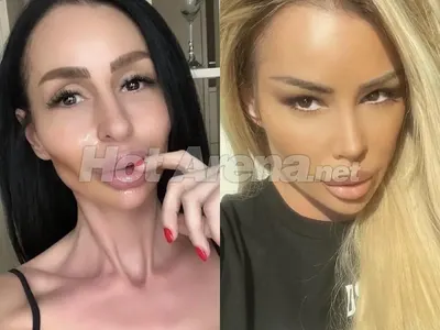 Ужасяващи резултати след серия корекции: Адриана стана Мис Пиги, БГ Барби плаши и още… (Снимки)