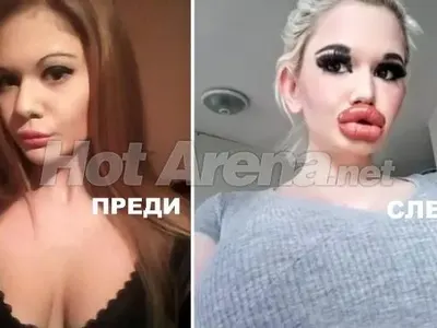 Ужасяващи резултати след серия корекции: Адриана стана Мис Пиги, БГ Барби плаши и още… (Снимки)