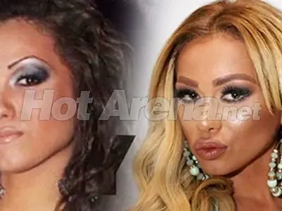 Ужасяващи резултати след серия корекции: Адриана стана Мис Пиги, БГ Барби плаши и още… (Снимки)