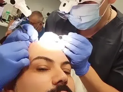 Мон Дьо чака да му поникне коса