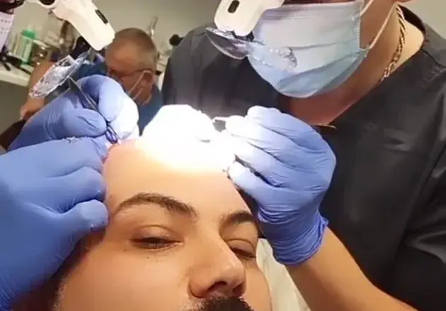 Мон Дьо чака да му поникне коса