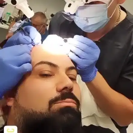 Мон Дьо чака да му поникне коса