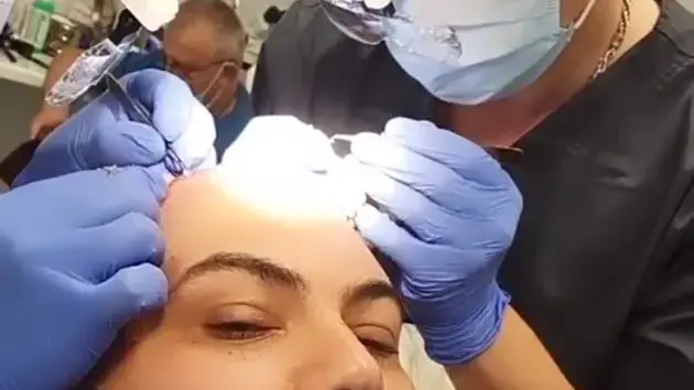 Мон Дьо чака да му поникне коса