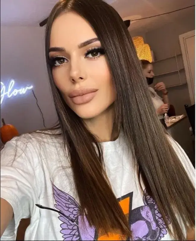 След 2 неуспешни опита: Снахата на Доган  си резна носа  за трети път