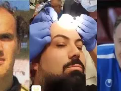 Мъжка суета! Родни актьори и футболист най-често си присаждат коса! Вижте кои са