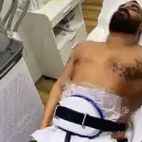 Азис топи тлъстини с липосукция