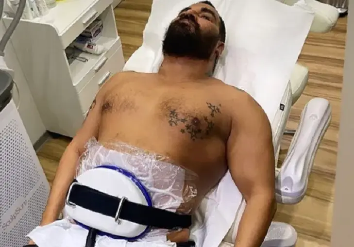 Азис топи тлъстини с липосукция