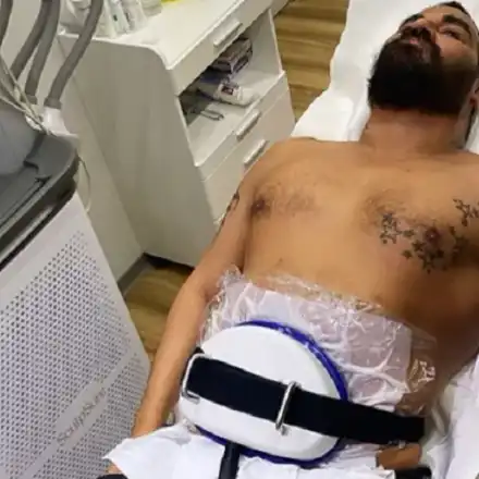 Азис топи тлъстини с липосукция