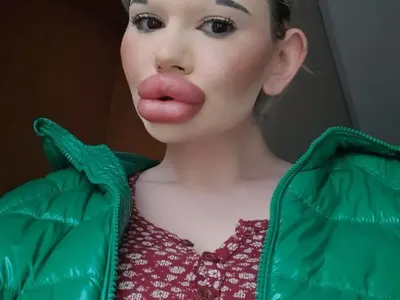 БГ Барби с нов рекорд - три операции за ден (Снимки)