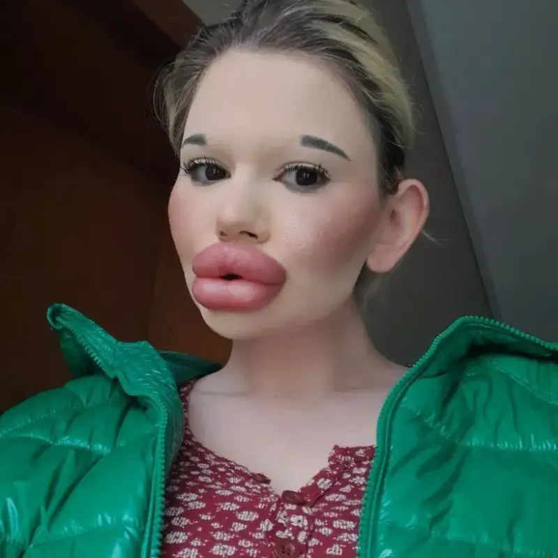 БГ Барби с нов рекорд - три операции за ден (Снимки)