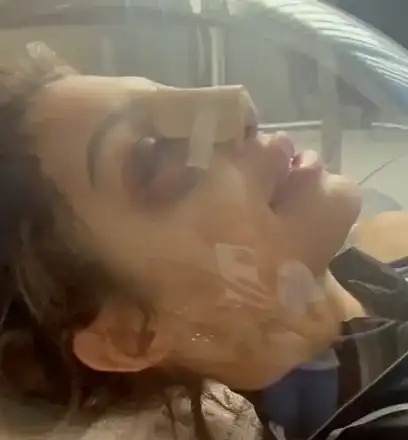 Джулиана Гани  си клъцна носа  за 3000 евро