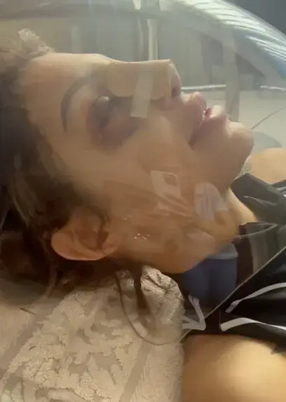 Джулиана Гани  си клъцна носа  за 3000 евро