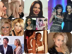 Кралици на скалпела – Райна с 12 операции на носа, Гани с 4, Преслава шокира с промяната...