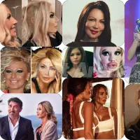 Кралици на скалпела – Райна с 12 операции на носа, Гани с 4, Преслава шокира с промяната...