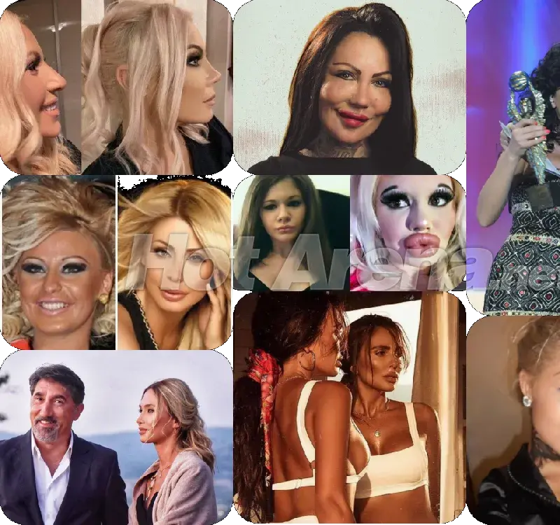 Кралици на скалпела – Райна с 12 операции на носа, Гани с 4, Преслава шокира с промяната...