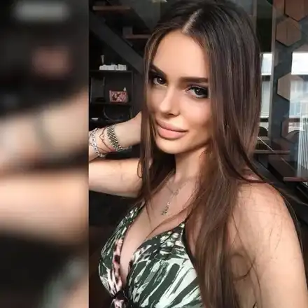 Снахата на Доган си клъцна носа за трети път