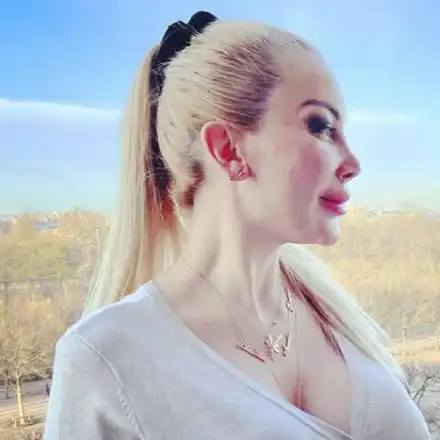 Тоца се окепази с филъри, лицето й стана на бабуни