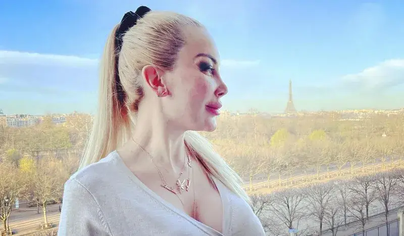 Тоца се окепази с филъри, лицето й стана на бабуни