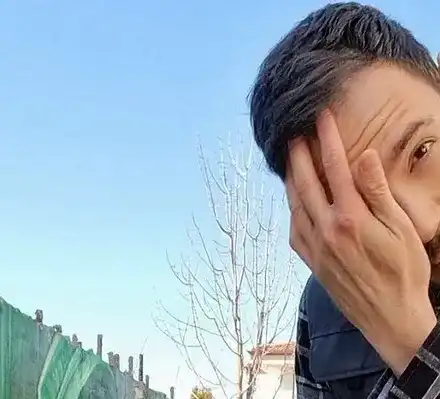 Даниел Петканов  се оплака от  изкуственото си теме: Пак съм плешив!