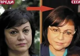 Корнелия Нинова се подмладява за 5 бона (Червената лидерка опъва бръчки в елитна клиника)