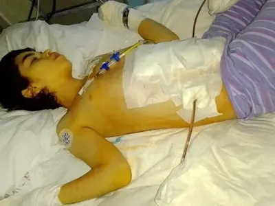 Денис Топал спасява 13-годишната Натали от нечовешки болки (Снимката не е за хора със слаби нерви)