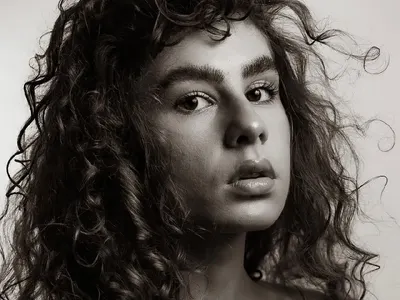 Щерката на президента претърпя злополука (Папарашки снимки)