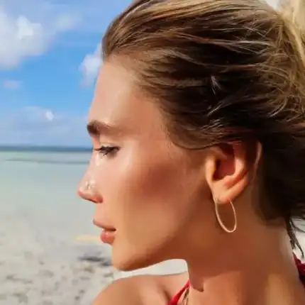 Тежка алергия мъчи държанката на Башар Рахал