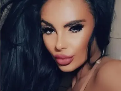 До пръсване: Мис Силикон наблъска пазвата с 2000 кубика (Умопомрачителна снимка)