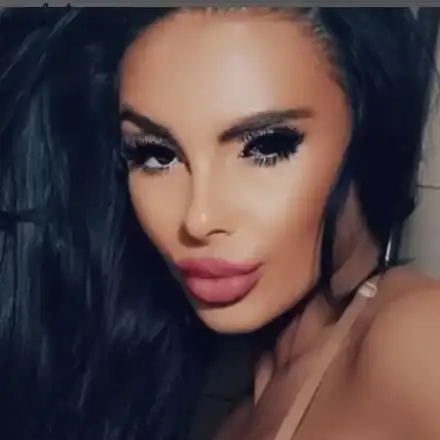 До пръсване: Мис Силикон наблъска пазвата с 2000 кубика (Умопомрачителна снимка)