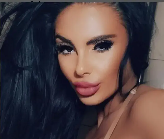 До пръсване: Мис Силикон наблъска пазвата с 2000 кубика (Умопомрачителна снимка)