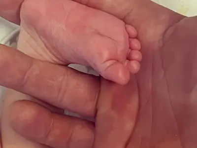 Бебето на плеймейтка в кувьоз (Първо ФОТО)