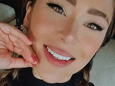 И Ася Капчикова си отряза носа, неузнаваема е! (Снимка)