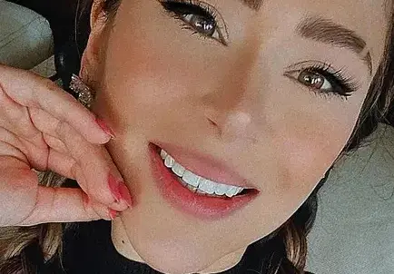 И Ася Капчикова си отряза носа, неузнаваема е! (Снимка)