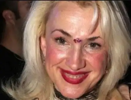 Сашка Васева прави зъби след операциите