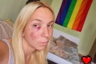 Eмили с тротинетката се оправи след катастрофата (Снимки)