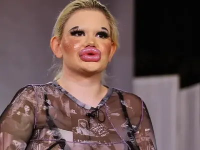 ПСИХАРИЯ: БГ Барби с рекордна 30-а корекция (Фото)