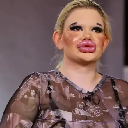 ПСИХАРИЯ: БГ Барби с рекордна 30-а корекция (Фото)