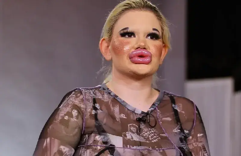 ПСИХАРИЯ: БГ Барби с рекордна 30-а корекция (Фото)