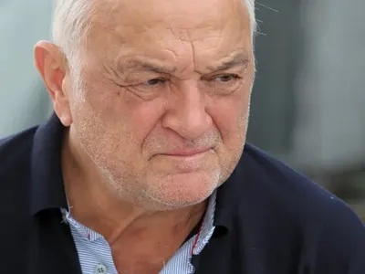 Сашо Диков след операцията: Имам  25-сантиметров белег от сърцето до гърлото