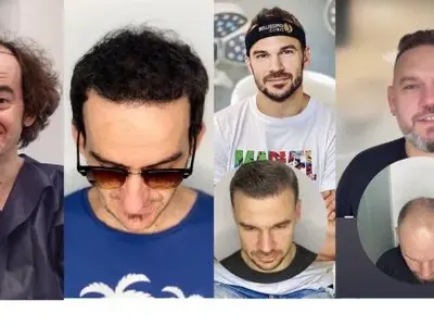 Трай, бабо, за хубост! Родни плешльовци пак развяха перчема!