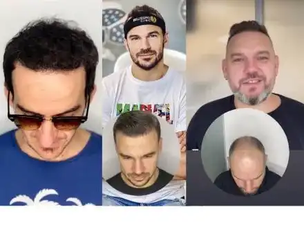 Трай, бабо, за хубост! Родни плешльовци пак развяха перчема!