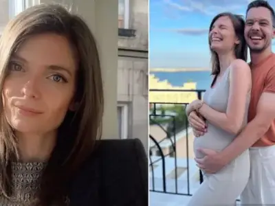 Ужас! Хормонало акне налегна Нора Шопова