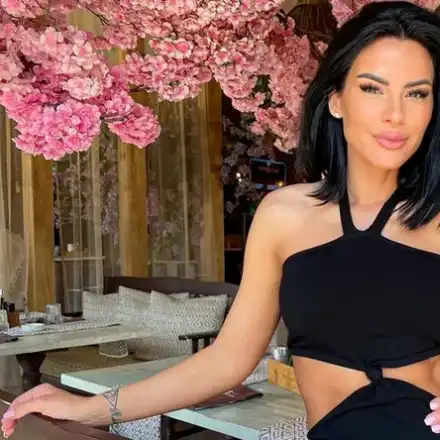 Цвети на Криско се наджаска с ботокс