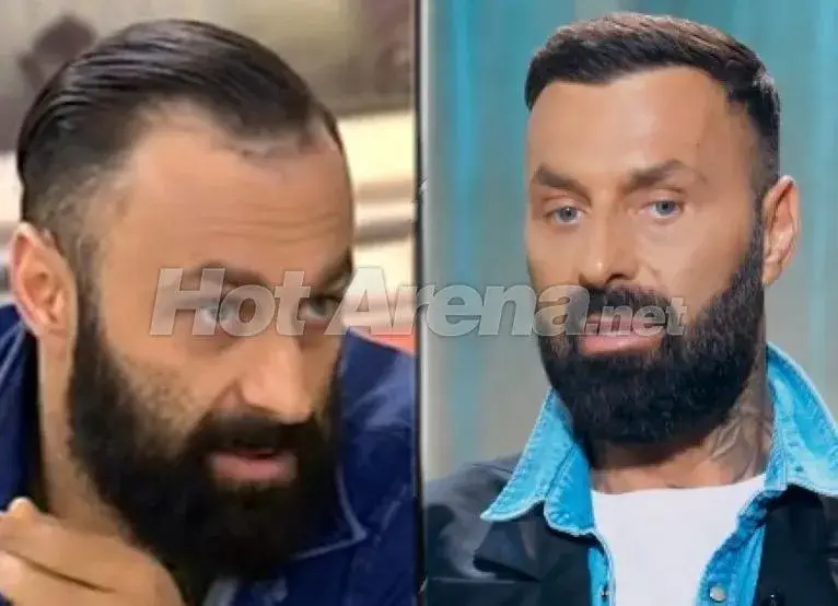 Диджей Дамян се ремонтира от-до в Турция