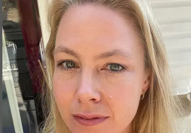 Съсипана от комплекси: Линда се готви за пластична операция в Дубай