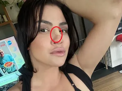 Кой разби носа на Деси Цонева?