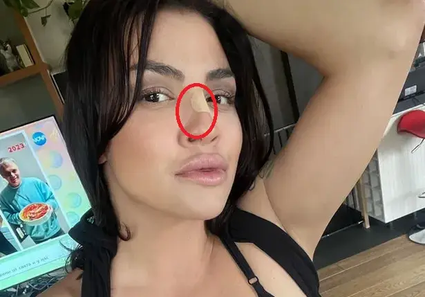 Кой разби носа на Деси Цонева?