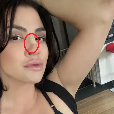 Кой разби носа на Деси Цонева?