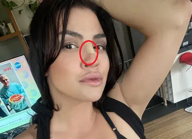 Кой разби носа на Деси Цонева?